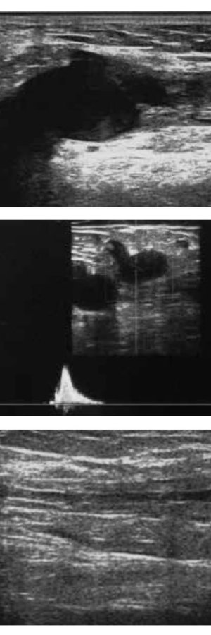 02_2_Fig2-3-4