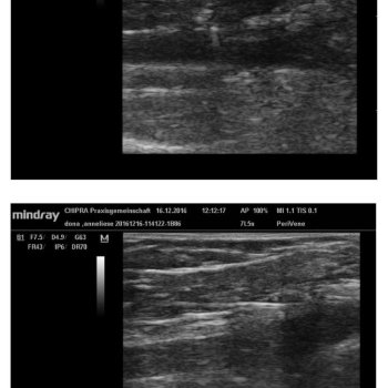 03_1_Fig3-4